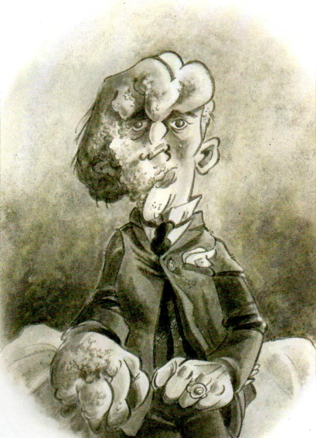 JOSEPH CAREY MERRICK - 1 . ELEPHANT MAN